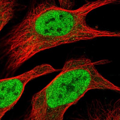 Immunocytochemistry/Immunofluorescence: PHF23 Antibody [NBP2-13756] - Immunofluorescent staining of human cell line U-2 OS shows localization to nucleoplasm.