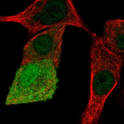 Immunocytochemistry/Immunofluorescence: APOA1BP Antibody [NBP2-30626] - Immunofluorescent staining of human cell line A549 shows localization to nucleoplasm & cytosol.