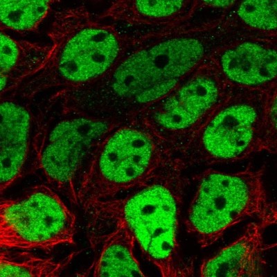 Immunocytochemistry/Immunofluorescence: BCL9-2 Antibody [NBP2-14350] - Immunofluorescent staining of human cell line CACO-2 shows localization to nucleoplasm.