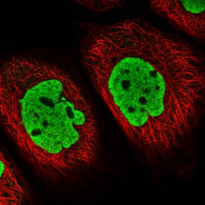 Immunocytochemistry/Immunofluorescence: ATP6V1E1 Antibody [NBP2-14335] - Immunofluorescent staining of human cell line A-431 shows localization to nucleoplasm.