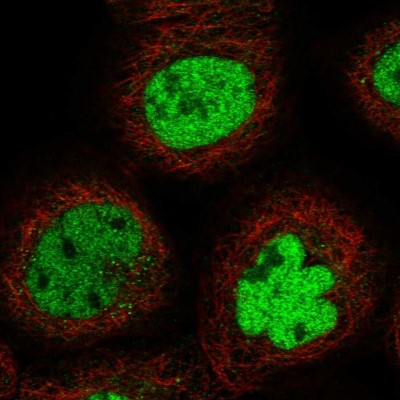 Immunocytochemistry/Immunofluorescence: REC8 Antibody [NBP1-87145] - Immunofluorescent staining of human cell line A-431 shows localization to nucleoplasm.