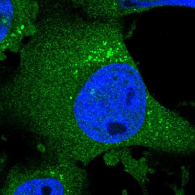 Immunocytochemistry/Immunofluorescence: CHSS2 Antibody [NBP1-88087] - Immunofluorescent staining of human cell line U-251 MG shows localization to cytosol, centrosome & vesicles.