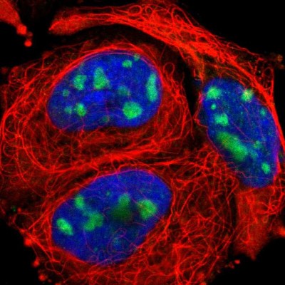 Immunocytochemistry/Immunofluorescence: KIAA0020 Antibody [NBP1-87296] - Immunofluorescent staining of human cell line A-431 shows localization to nucleoli.