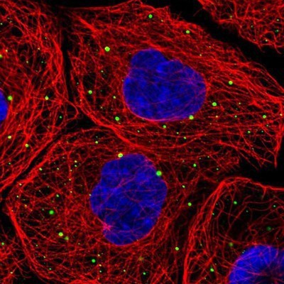 Immunocytochemistry/Immunofluorescence: LSM14A Antibody [NBP1-88473] - Staining of human cell line A-431 shows positivity in vesicles.