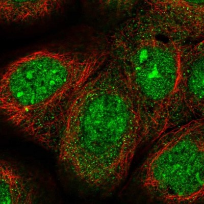 Immunocytochemistry/Immunofluorescence: CAPS2 Antibody [NBP1-85855] - Staining  of human cell line A-431 shows positivity in nucleus, nucleoli, cytoplasm and centrosome.