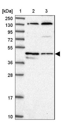 Western Blot: C14orf80 Antibody [NBP1-85864] - Lane 1: Marker  [kDa] 250, 130, 95, 72, 55, 36, 28, 17, 10.  Lane 2: Human cell line RT-4.  Lane 3: Human cell line U-251MG sp