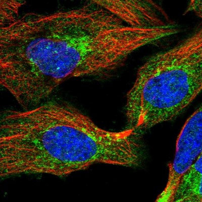 Immunocytochemistry/Immunofluorescence: C14orf80 Antibody [NBP1-85864] - Immunofluorescent staining of human cell line U-2 OS shows localization to cytosol & the Golgi apparatus.