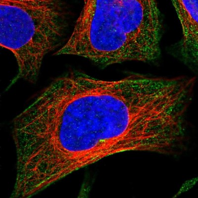 Immunocytochemistry/Immunofluorescence: CCDC167 Antibody [NBP1-94107] - Immunofluorescent staining of human cell line U-2 OS shows localization to cytosol & actin filaments.