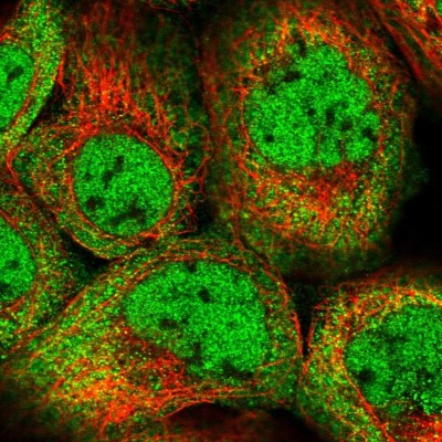 Immunocytochemistry/Immunofluorescence: FAM13C1 Antibody [NBP1-91884] - Immunofluorescent staining of human cell line A-431 shows localization to nucleoplasm & cytosol.