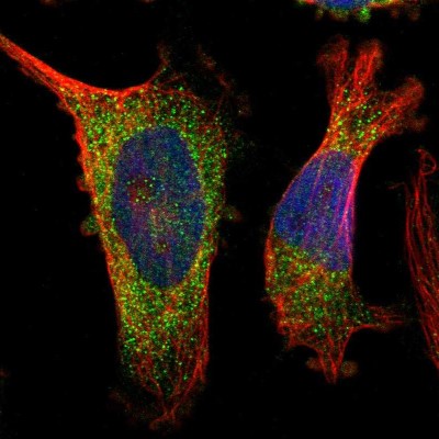Immunocytochemistry/Immunofluorescence: IL-28 R alpha/IFN-lambda R1 Antibody [NBP1-84381] - Immunofluorescent staining of human cell line U-251 MG shows localization to cytosol.