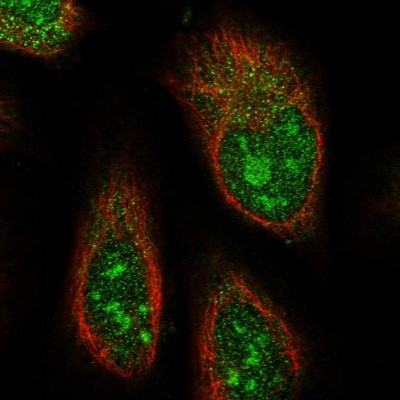 Immunocytochemistry/Immunofluorescence: ABHD14B Antibody [NBP1-84472] - Immunofluorescent staining of human cell line U-2 OS shows localization to nucleus, nucleoli & cytosol.