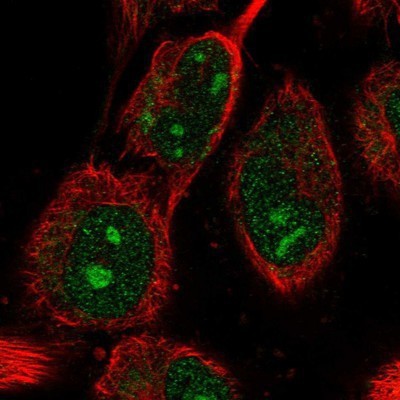 Immunocytochemistry/Immunofluorescence: ABHD14B Antibody [NBP1-84472] - Staining of human cell line U-251 MG shows positivity in nucleus, nucleoli and cytoplasm.