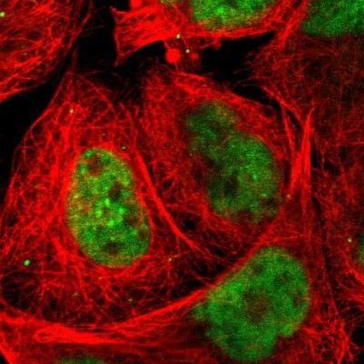 Immunocytochemistry/Immunofluorescence: FAM122B Antibody [NBP1-90508] - Immunofluorescent staining of human cell line A-431 shows localization to nucleoplasm.