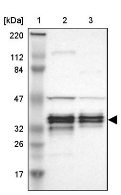 Western Blot: C1orf198 Antibody [NBP1-90519] - Lane 1: Marker  [kDa] 220, 112, 84, 47, 32, 26, 17.  Lane 2: Human cell line RT-4.  Lane 3: Human cell line U-251MG sp