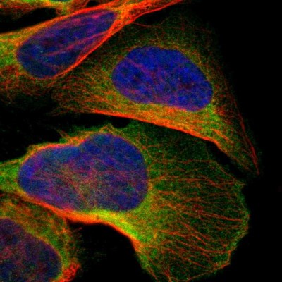 Immunocytochemistry/Immunofluorescence: C1orf198 Antibody [NBP1-90519] - Immunofluorescent staining of human cell line U-2 OS shows localization to cytosol.