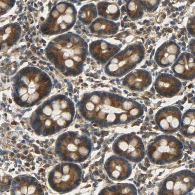Immunohistochemistry-Paraffin: C1orf198 Antibody [NBP1-90519] - Staining of human duodenum shows strong cytoplasmic positivity in glandular cells.