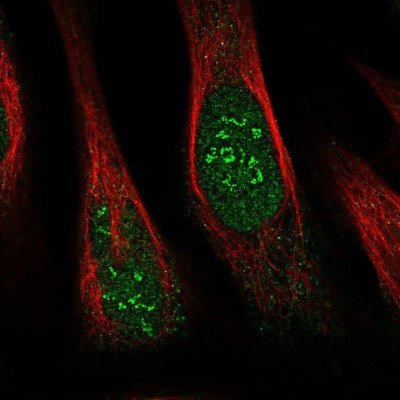 Immunocytochemistry/Immunofluorescence: THYN1 Antibody [NBP1-86942] - Immunofluorescent staining of human cell line U-2 OS shows localization to nucleus & nucleoli fibrillar center.