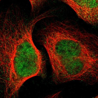 Immunocytochemistry/Immunofluorescence: TAPP1/PLEKHA1 Antibody [NBP1-86967] - Staining of human cell line U-2 OS shows localization to nucleus & cytosol.