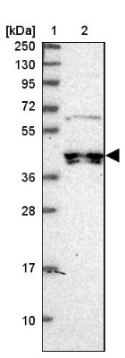 Western Blot: C2orf62 Antibody [NBP1-91729] - Lane 1: Marker  [kDa] 250, 130, 95, 72, 55, 36, 28, 17, 10.  Lane 2: Human cell line RT-4