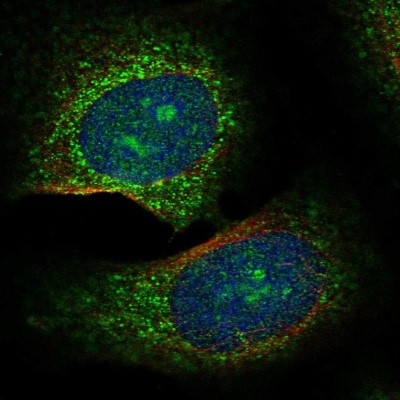 Immunocytochemistry/Immunofluorescence: C2orf62 Antibody [NBP1-91729] - Staining of human cell line U-2 OS shows positivity in nucleoli and cytoplasm.