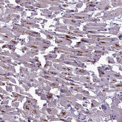 Immunohistochemistry-Paraffin: C2orf62 Antibody [NBP1-91729] - Staining of human heart muscle shows distinct cytoplasmic positivity in myocytes.