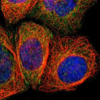 Immunocytochemistry/Immunofluorescence: Angiomotin like 1 Antibody [NBP1-91665] - Immunofluorescent staining of human cell line A-431 shows localization to cytosol & cell junctions.