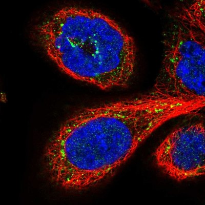 Immunocytochemistry/Immunofluorescence: GPSM1 Antibody [NBP1-91968] - Immunofluorescent staining of human cell line A-431 shows localization to the Golgi apparatus.