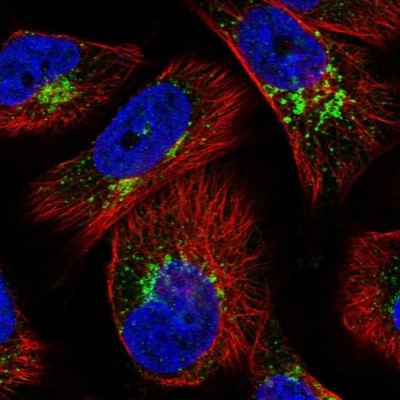 Immunocytochemistry/Immunofluorescence: WDTC1 Antibody [NBP1-89234] - Immunofluorescent staining of human cell line U-251 MG shows localization to the Golgi apparatus & vesicles.