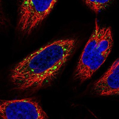Immunocytochemistry/Immunofluorescence: WDTC1 Antibody [NBP1-89234] - Staining of human cell line U-2 OS shows positivity in vesicles.