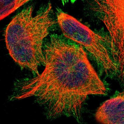 Immunocytochemistry/Immunofluorescence: PDLIM5 Antibody [NBP1-84843] - Immunofluorescent staining of human cell line U-251 MG shows localization to plasma membrane, cytosol & focal adhesion sites.