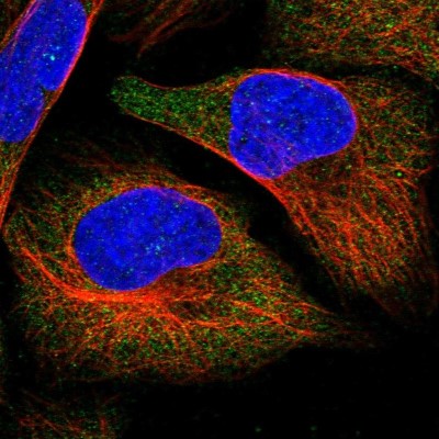 Immunocytochemistry/Immunofluorescence: APEH Antibody [NBP1-85333] - Immunofluorescent staining of human cell line U-2 OS shows localization to cytosol.
