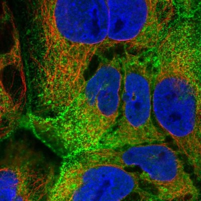 Immunocytochemistry/Immunofluorescence: Villin 1 Antibody [NBP1-85336] - Immunofluorescent staining of human cell line CACO-2 shows localization to nucleoplasm & plasma membrane.