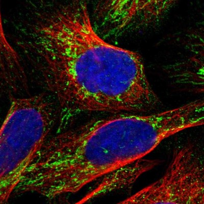 Immunocytochemistry/Immunofluorescence: NDUFV3 Antibody [NBP1-85622] - Immunofluorescent staining of human cell line U-2 OS shows localization to mitochondria.