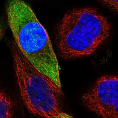 Immunocytochemistry/Immunofluorescence: ACOT7 Antibody [NBP1-89278] - Immunofluorescent staining of human cell line A-431 shows localization to nucleoplasm & cytosol.
