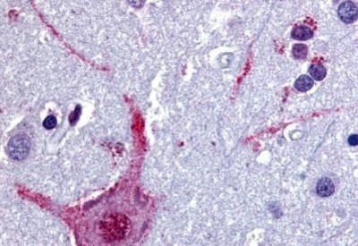 Immunohistochemistry-Paraffin: Muscarinic Acetylcholine Receptor M3/CHRM3 Antibody [NB100-58978] - Analysis of anti-CHRM3 / M3 antibody with human brain, cortex at oncentration 5 ug/ml.