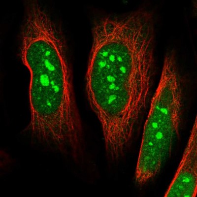 Immunocytochemistry/Immunofluorescence: DDX55 Antibody [NBP2-47490] - Immunofluorescent staining of human cell line U-2 OS shows localization to nucleus & nucleoli.