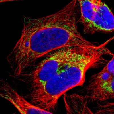 Immunocytochemistry/Immunofluorescence: ME2 Antibody [NBP1-82434] - Immunofluorescent staining of human cell line U-2 OS shows localization to mitochondria.