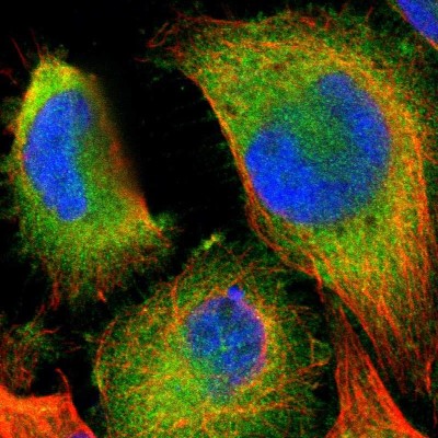 Immunocytochemistry/Immunofluorescence: Ymer Antibody [NBP1-88265] - Immunofluorescent staining of human cell line U-251 MG shows localization to cytosol.