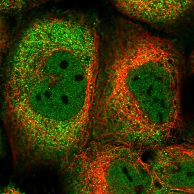 Immunocytochemistry/Immunofluorescence: FAM190B Antibody [NBP1-81438] - Immunofluorescent staining of human cell line A-431 shows localization to nucleoplasm & cytosol.