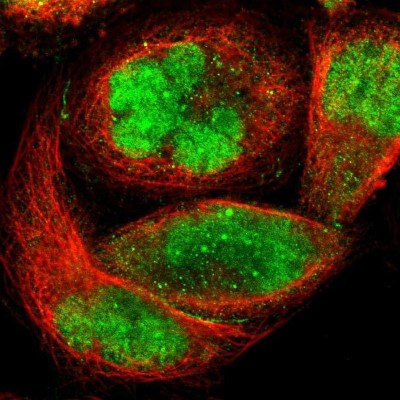 Immunocytochemistry/Immunofluorescence: ZKSCAN1 Antibody [NBP1-81346] - Staining of human cell line A-431 shows localization to nucleus & nuclear bodies.