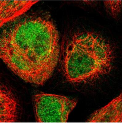 Immunocytochemistry/Immunofluorescence: COMMD9 Antibody [NBP1-82027] - Staining of human cell line A-431 shows localization to nucleus & cytosol. Antibody staining is shown in green.