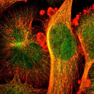 Immunocytochemistry/Immunofluorescence: CCDC117 Antibody [NBP1-81977] - Immunofluorescent staining of human cell line U-251 MG shows localization to nucleus, cytosol & microtubules.