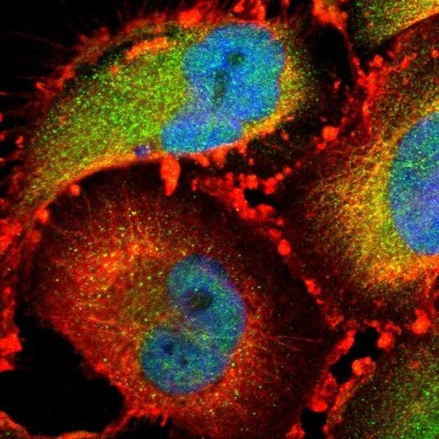Immunocytochemistry/Immunofluorescence: CCDC117 Antibody [NBP1-81977] - Staining of human cell line U-251MG shows positivity in nucleus, cytoplasm and cytoskeleton (microtubules).