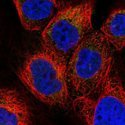 Immunocytochemistry/Immunofluorescence: PET112L Antibody [NBP1-80925] - Immunofluorescent staining of human cell line A-431 shows localization to mitochondria.