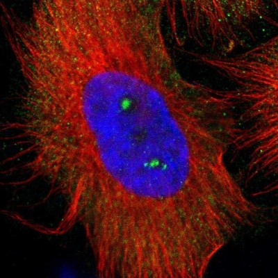 Immunocytochemistry/Immunofluorescence: p67phox/NOXA2 Antibody [NBP1-82542] - Staining of human cell line U-251 MG shows localization to nucleoli & cytosol.
