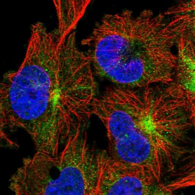 Immunocytochemistry/Immunofluorescence: TRIM46 Antibody [NBP1-82088] - Immunofluorescent staining of human cell line U-251 MG shows localization to cytosol & intermediate filaments.