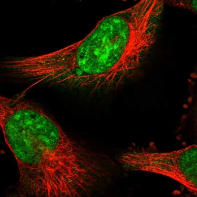 Immunocytochemistry/Immunofluorescence: PSMD13 Antibody [NBP1-80961] - Immunofluorescent staining of human cell line U-251 MG shows localization to nucleoli & nuclear speckles.