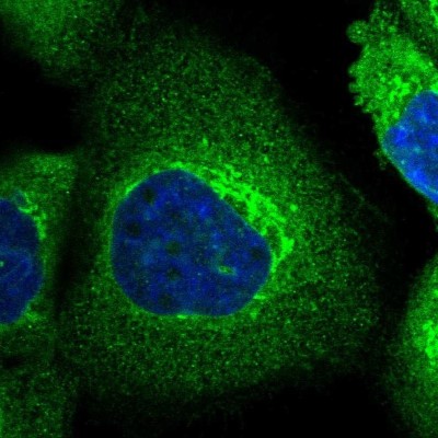Immunocytochemistry/Immunofluorescence: SLC39A14 Antibody [NBP1-81551] - Staining of human cell line A-431 shows localization to plasma membrane, endoplasmic reticulum & the Golgi apparatus.