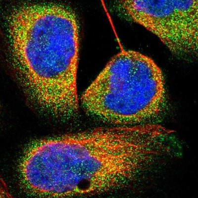 Immunocytochemistry/Immunofluorescence: TRIM4 Antibody [NBP1-80824] - Immunofluorescent staining of human cell line A-431 shows localization to cytosol.