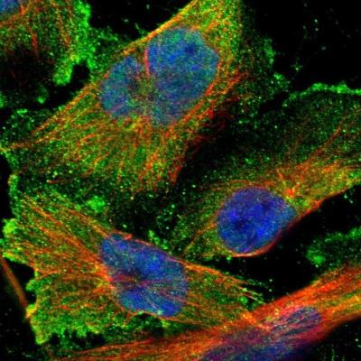 Immunocytochemistry/ Immunofluorescence: C21orf59 Antibody [NBP1-88276] - Staining of human cell line U-251 MG shows positivity in plasma membrane.